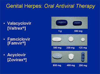 Herpes Treatment